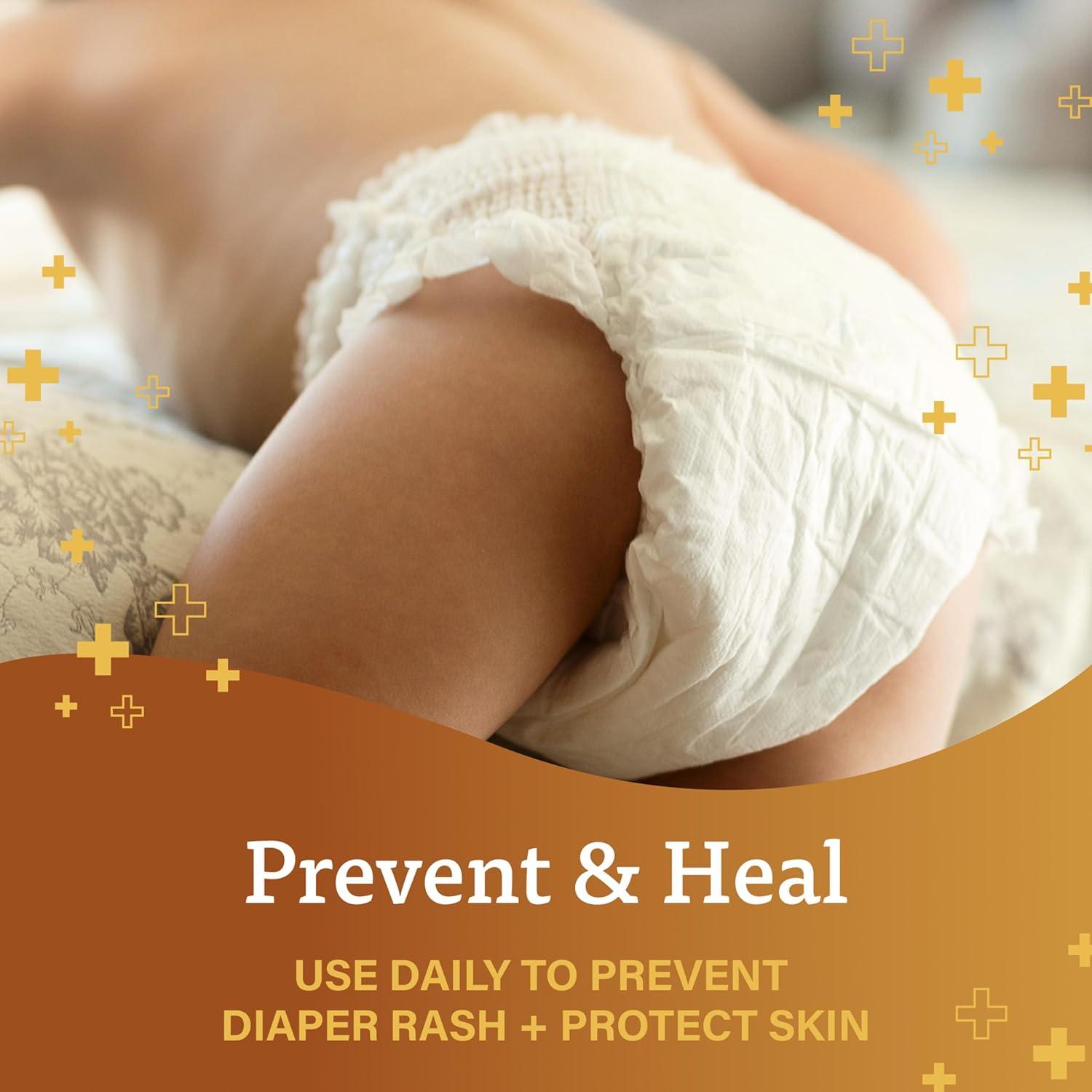 A+D Original Diaper Rash Ointment: Gentle Care for Baby’s Skin